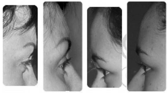 Иллюстрация к книге — Биогимнастика для лица: система фейсмионика [i_088.jpg]