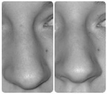 Иллюстрация к книге — Биогимнастика для лица: система фейсмионика [i_089.jpg]