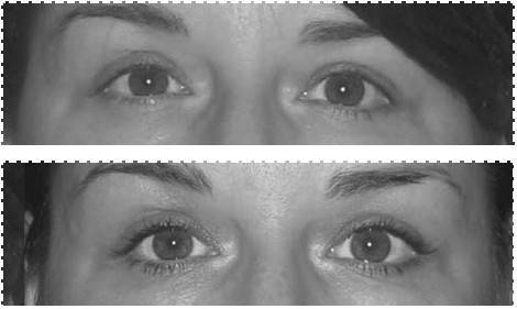 Иллюстрация к книге — Биогимнастика для лица: система фейсмионика [i_105.jpg]