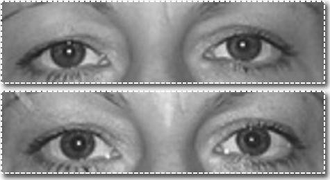 Иллюстрация к книге — Биогимнастика для лица: система фейсмионика [i_109.jpg]