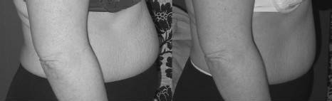 Иллюстрация к книге — Биогимнастика для лица: система фейсмионика [i_114.jpg]