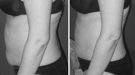 Иллюстрация к книге — Биогимнастика для лица: система фейсмионика [i_117.jpg]