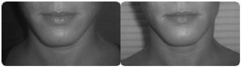 Иллюстрация к книге — Биогимнастика для лица: система фейсмионика [i_118.jpg]