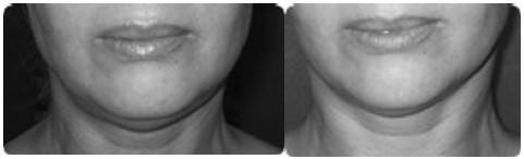 Иллюстрация к книге — Биогимнастика для лица: система фейсмионика [i_123.jpg]