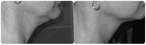 Иллюстрация к книге — Биогимнастика для лица: система фейсмионика [i_126.jpg]