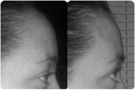 Иллюстрация к книге — Биогимнастика для лица: система фейсмионика [i_129.jpg]