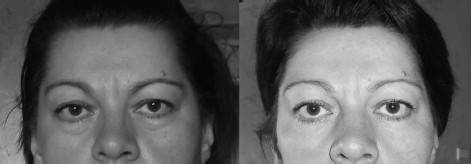 Иллюстрация к книге — Биогимнастика для лица: система фейсмионика [i_138.jpg]