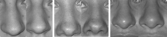 Иллюстрация к книге — Биогимнастика для лица: система фейсмионика [i_142.jpg]