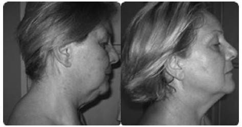 Иллюстрация к книге — Биогимнастика для лица: система фейсмионика [i_144.jpg]