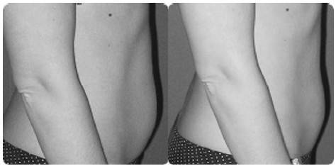 Иллюстрация к книге — Биогимнастика для лица: система фейсмионика [i_147.jpg]