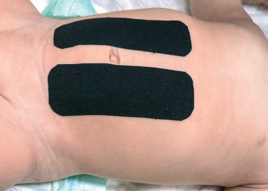 Иллюстрация к книге — Кинезиотейпинг в лечебной практике неврологии и ортопедии [i_008.jpg]