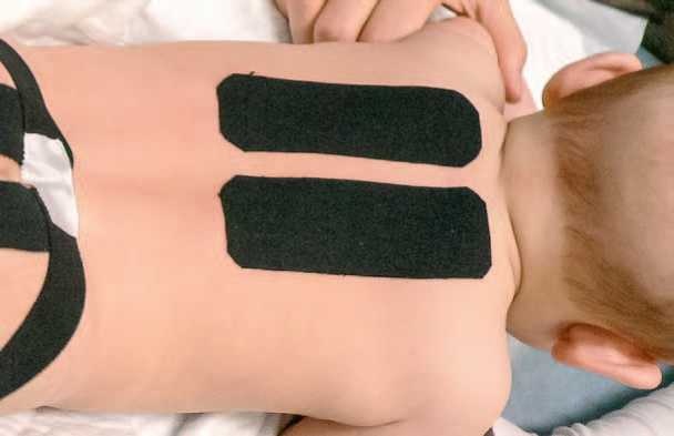 Иллюстрация к книге — Кинезиотейпинг в лечебной практике неврологии и ортопедии [i_009.jpg]