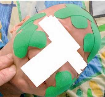 Иллюстрация к книге — Кинезиотейпинг в лечебной практике неврологии и ортопедии [i_017.jpg]