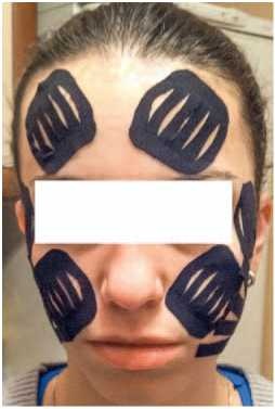 Иллюстрация к книге — Кинезиотейпинг в лечебной практике неврологии и ортопедии [i_023.jpg]