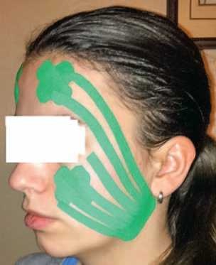 Иллюстрация к книге — Кинезиотейпинг в лечебной практике неврологии и ортопедии [i_026.jpg]