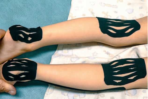 Иллюстрация к книге — Кинезиотейпинг в лечебной практике неврологии и ортопедии [i_035.jpg]