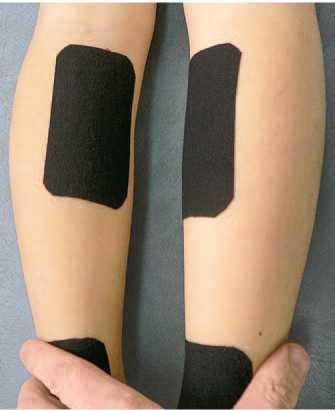 Иллюстрация к книге — Кинезиотейпинг в лечебной практике неврологии и ортопедии [i_043.jpg]