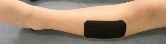 Иллюстрация к книге — Кинезиотейпинг в лечебной практике неврологии и ортопедии [i_044.jpg]