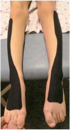 Иллюстрация к книге — Кинезиотейпинг в лечебной практике неврологии и ортопедии [i_046.jpg]