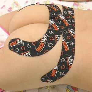 Иллюстрация к книге — Кинезиотейпинг в лечебной практике неврологии и ортопедии [i_058.jpg]