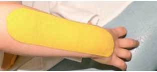 Иллюстрация к книге — Кинезиотейпинг в лечебной практике неврологии и ортопедии [i_060.jpg]