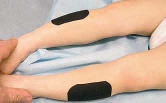 Иллюстрация к книге — Кинезиотейпинг в лечебной практике неврологии и ортопедии [i_071.jpg]