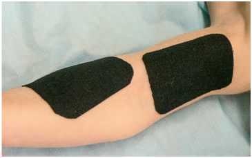 Иллюстрация к книге — Кинезиотейпинг в лечебной практике неврологии и ортопедии [i_075.jpg]