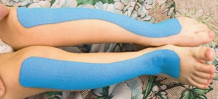 Иллюстрация к книге — Кинезиотейпинг в лечебной практике неврологии и ортопедии [i_083.jpg]