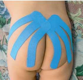 Иллюстрация к книге — Кинезиотейпинг в лечебной практике неврологии и ортопедии [i_087.jpg]