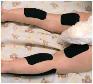 Иллюстрация к книге — Кинезиотейпинг в лечебной практике неврологии и ортопедии [i_088.jpg]