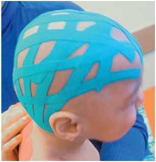 Иллюстрация к книге — Кинезиотейпинг в лечебной практике неврологии и ортопедии [i_090.jpg]