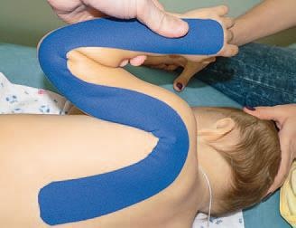 Иллюстрация к книге — Кинезиотейпинг в лечебной практике неврологии и ортопедии [i_093.jpg]