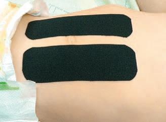 Иллюстрация к книге — Кинезиотейпинг в лечебной практике неврологии и ортопедии [i_095.jpg]