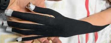 Иллюстрация к книге — Кинезиотейпинг в лечебной практике неврологии и ортопедии [i_101.jpg]