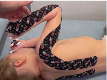 Иллюстрация к книге — Кинезиотейпинг в лечебной практике неврологии и ортопедии [i_104.jpg]