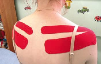 Иллюстрация к книге — Кинезиотейпинг в лечебной практике неврологии и ортопедии [i_109.jpg]