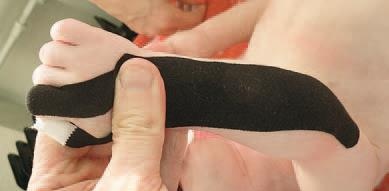 Иллюстрация к книге — Кинезиотейпинг в лечебной практике неврологии и ортопедии [i_110.jpg]