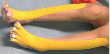 Иллюстрация к книге — Кинезиотейпинг в лечебной практике неврологии и ортопедии [i_114.jpg]