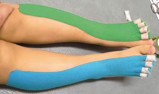 Иллюстрация к книге — Кинезиотейпинг в лечебной практике неврологии и ортопедии [i_115.jpg]