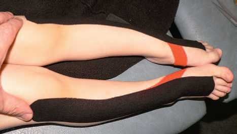 Иллюстрация к книге — Кинезиотейпинг в лечебной практике неврологии и ортопедии [i_118.jpg]