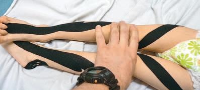 Иллюстрация к книге — Кинезиотейпинг в лечебной практике неврологии и ортопедии [i_125.jpg]