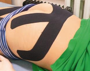 Иллюстрация к книге — Кинезиотейпинг в лечебной практике неврологии и ортопедии [i_132.jpg]