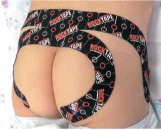 Иллюстрация к книге — Кинезиотейпинг в лечебной практике неврологии и ортопедии [i_133.jpg]