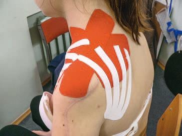 Иллюстрация к книге — Кинезиотейпинг в лечебной практике неврологии и ортопедии [i_149.jpg]