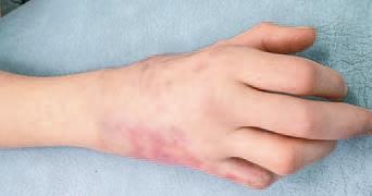 Иллюстрация к книге — Кинезиотейпинг в лечебной практике неврологии и ортопедии [i_159.jpg]