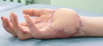 Иллюстрация к книге — Кинезиотейпинг в лечебной практике неврологии и ортопедии [i_161.jpg]