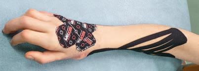 Иллюстрация к книге — Кинезиотейпинг в лечебной практике неврологии и ортопедии [i_163.jpg]