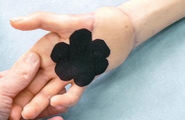 Иллюстрация к книге — Кинезиотейпинг в лечебной практике неврологии и ортопедии [i_165.jpg]