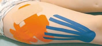 Иллюстрация к книге — Кинезиотейпинг в лечебной практике неврологии и ортопедии [i_172.jpg]