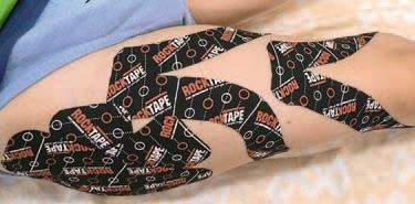 Иллюстрация к книге — Кинезиотейпинг в лечебной практике неврологии и ортопедии [i_178.jpg]